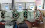 Способы прочистки теплообменника газового котла